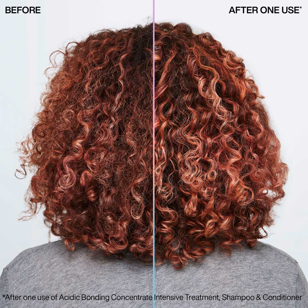 ABC Intensive Treatment 150ml