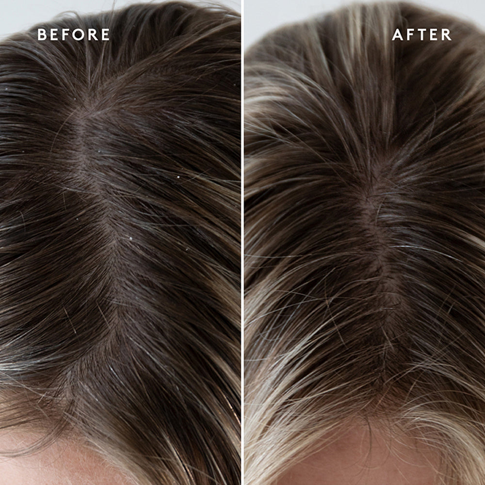 Scalp Exfoliating Treatment 150ml