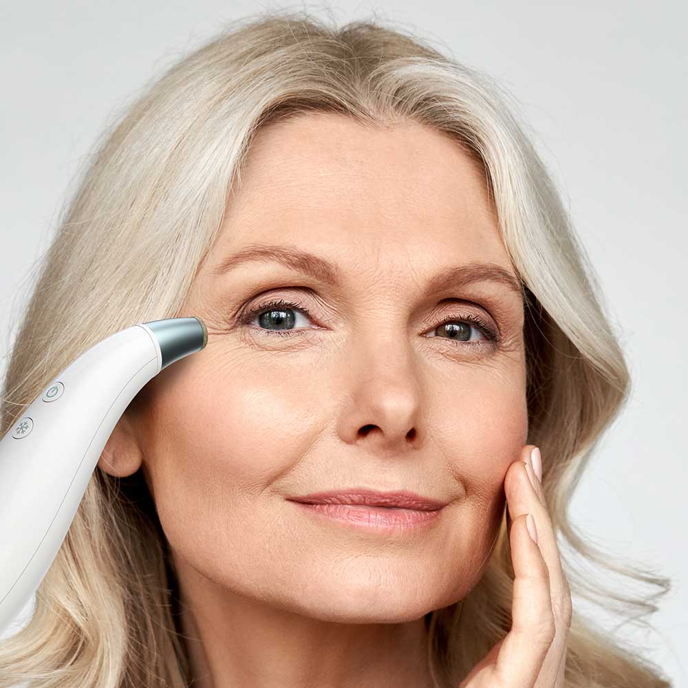 Radiance Microdermabrasion with Cooling